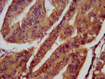 FBXL20 Antibody