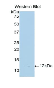 S100A6 / Calcyclin Antibody (aa1-90)