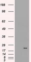 IHC-plus™ CRYAB / Alpha B Crystallin Antibody (clone 6D11)