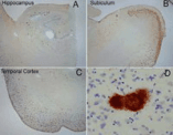 Polyclonal Rabbit anti-Human Amyloid Fibrils Antibody (IHC, WB)