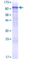 Human TGM4 / Transglutaminase 4 Protein (Recombinant GST)