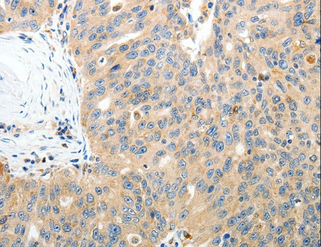 Polyclonal Rabbit anti-Human RAMP3 Antibody (IHC)