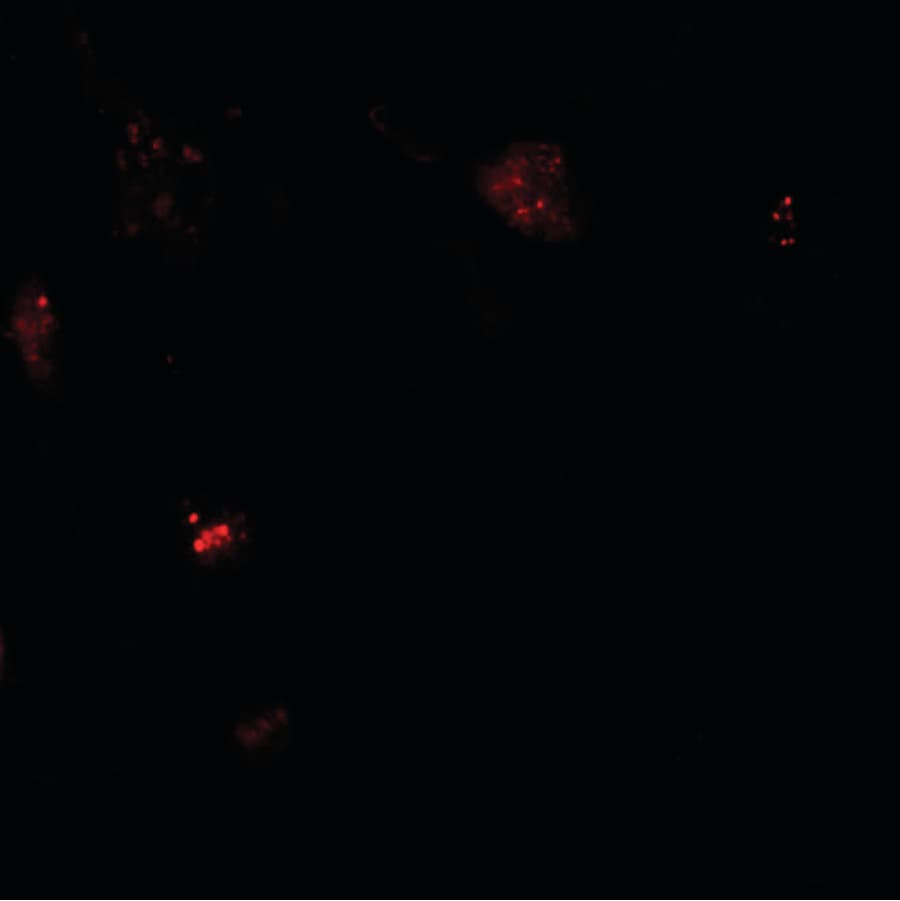 NBN / Nibrin Antibody