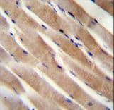 Polyclonal Rabbit anti-Human RHEB Antibody (aa104-134, IHC, WB)