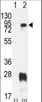 Polyclonal Rabbit anti-Human PRMT7 Antibody (aa1-30, IHC, WB)