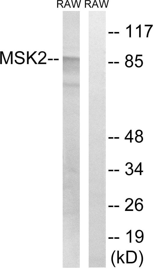 Polyclonal Rabbit anti-Human RPS6KA4 / MSK2 / RSK-B Antibody (p568, WB)