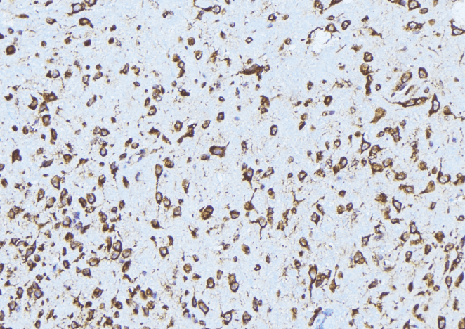 ABCA3 Antibody (aa485-535)