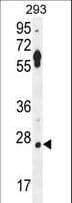 LRRC57 Antibody (aa198-227)