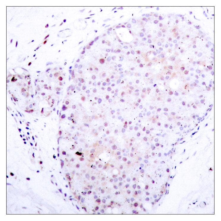 NFKB1 / NF-Kappa-B Antibody (p907)