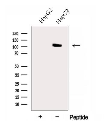 Polyclonal Rabbit anti-Human EXOC6 / SEC15 Antibody (WB)