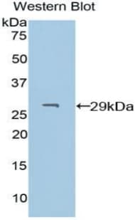 PDXK / PNK Antibody (aa29-253, FITC)