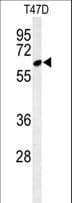 CLPB Antibody (aa673-702)