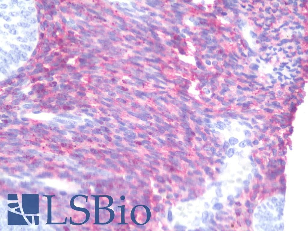 IHC-plus™ GJA1 / CX43 / Connexin 43 Antibody (C-Terminus)