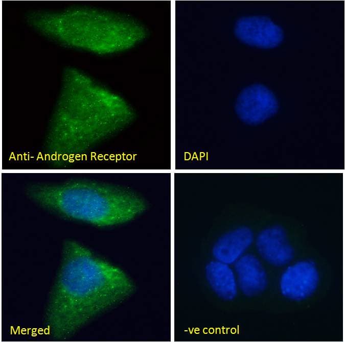 Polyclonal Goat anti-Human AR / Androgen Receptor Antibody (aa2-16, IHC, IF, WB)