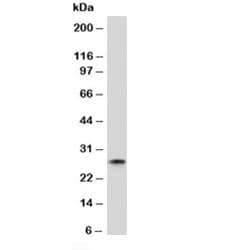 Mouse Anti-Human Kappa Light Chain Secondary Antibody (clone KC3L-1)