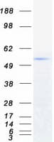 Human TRIM6 Protein (Recombinant Myc-DDK (Flag))