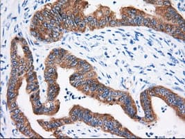 IGF2BP2 Antibody (clone OTI3C8)