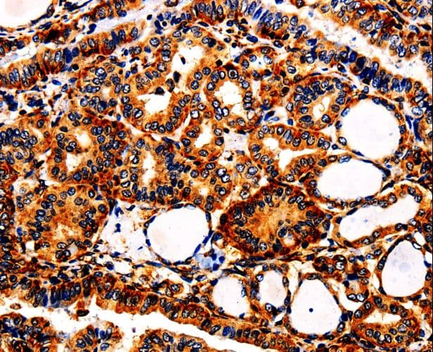 APLP1 / APLP-1 Antibody