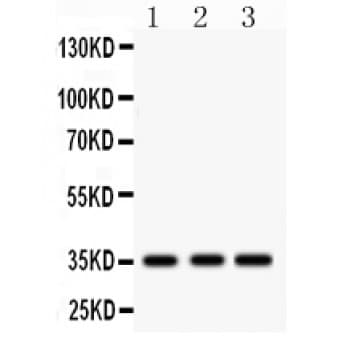 IGFBP2 / IGF-BP53 Antibody (aa228-257)