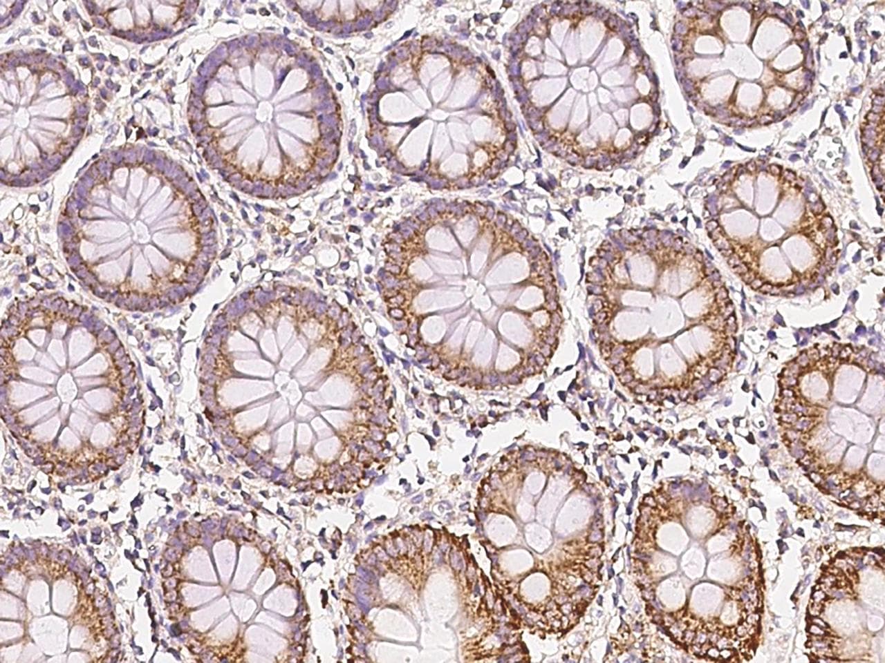 Polyclonal Rabbit anti-Human NIN / Ninein Antibody (IHC)