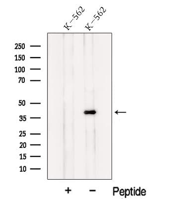 NF45 / ILF2 Antibody