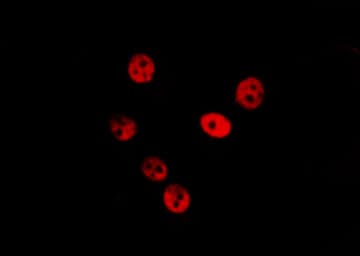 Polyclonal Rabbit anti-Human SUGP2 / SFRS14 Antibody (IF, WB)