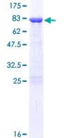 Human DDX19A Protein (Recombinant GST)