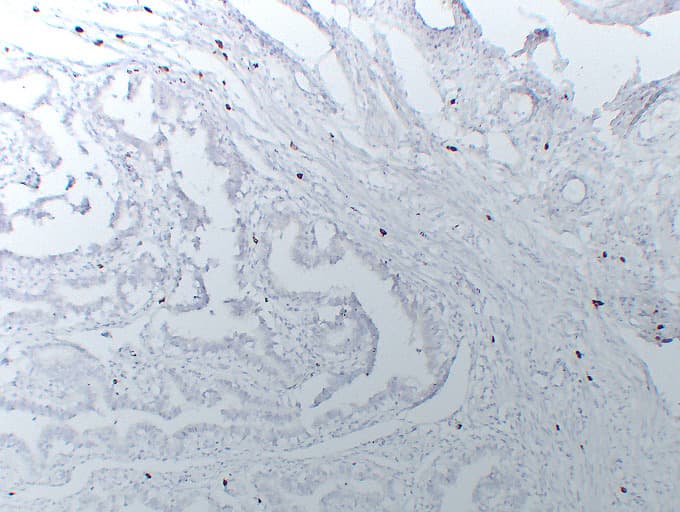 PathPlus™ Monoclonal Mouse anti-Human TPSAB1 / Mast Cell Tryptase Antibody (clone ABT-MCT, IHC)