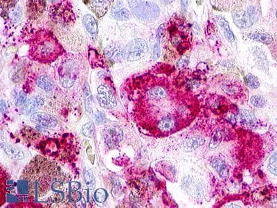 PathPlus™ GPR152 Antibody (Cytoplasmic Domain)