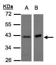 Polyclonal Rabbit anti-Human NDUFA10 Antibody (aa43-355, IHC, WB)