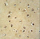 GABRG2 Antibody (aa198-224)