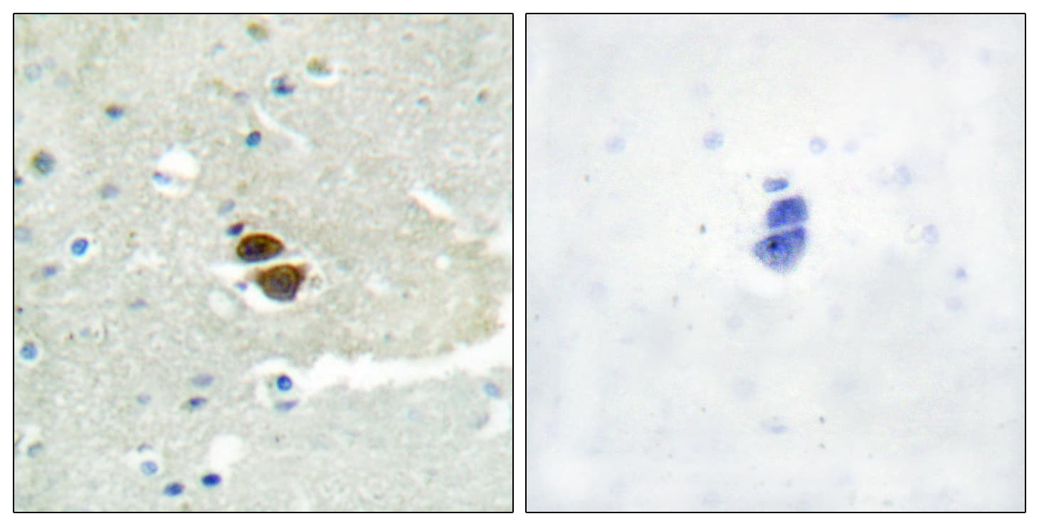 NOS1 / nNOS Antibody (phospho-Ser852)
