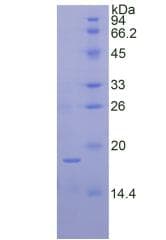 Human RNASE7 Protein (Recombinant His, N-Terminal)