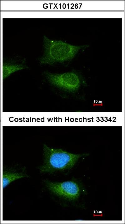 GBA / Glucosidase Beta Acid Antibody (aa352-536)