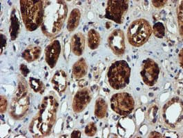 NQO2 Antibody (clone OTI3G4)