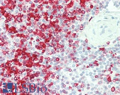 IHC-plus™ MELK Antibody (aa525-575)