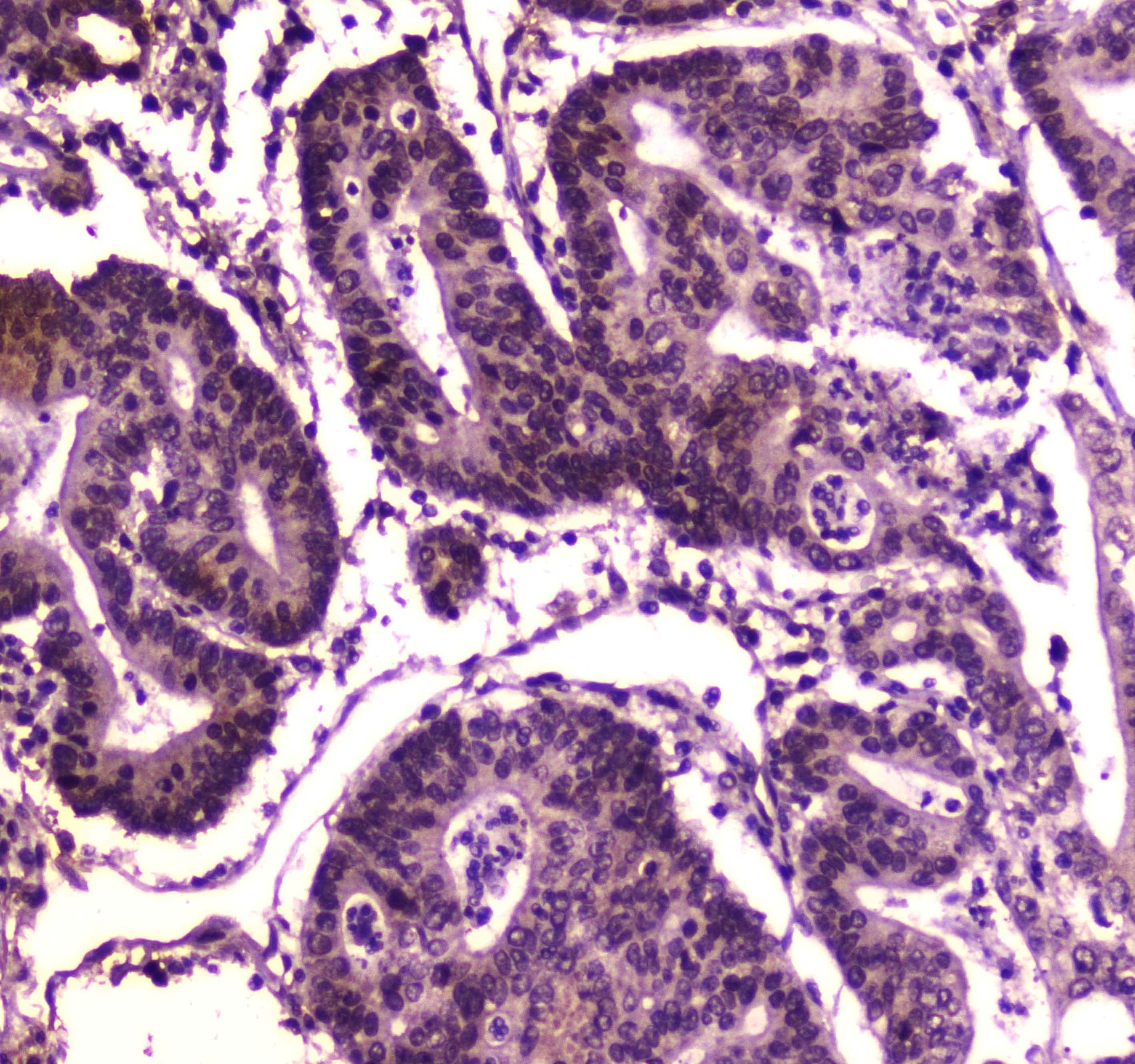 Polyclonal Rabbit anti-Human SMARCA4 / BRG1 Antibody (IHC, WB)
