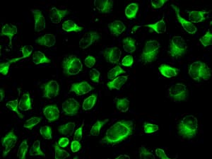 IHC-plus™ Monoclonal Rabbit anti-Human CLPTM1 Antibody (clone EPR8800, N-Terminus, IHC, IF, WB)