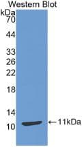 CCL17 / TARC Antibody (aa12-83)