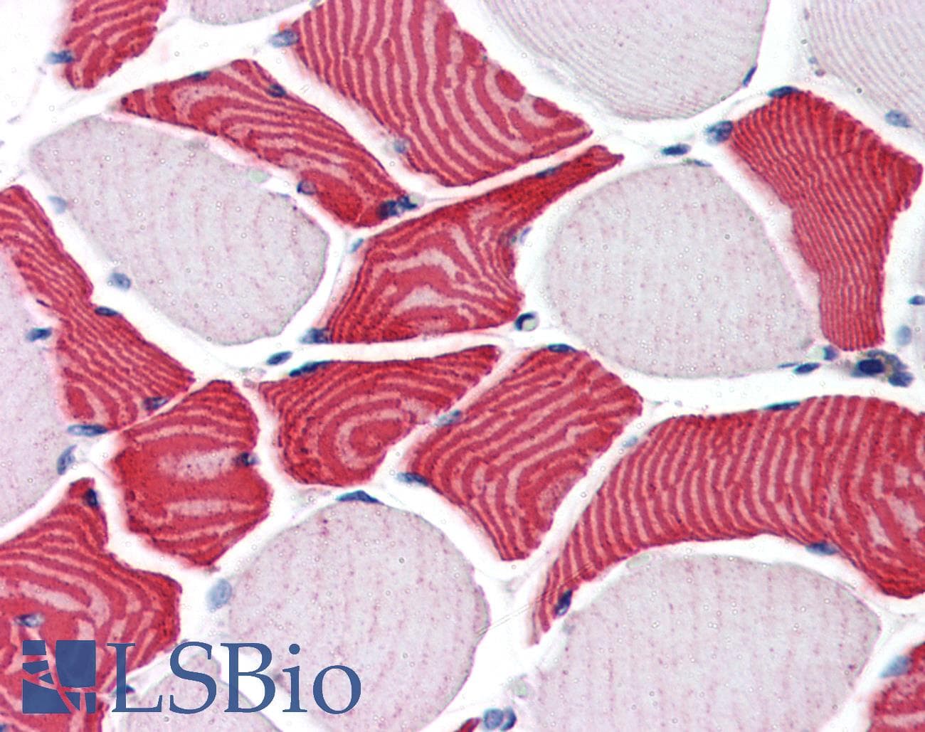 IHC-plus™ EBAG9 / RCAS1 Antibody (aa240-251)