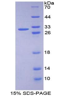Human PRKD1 / PKC Mu Protein (Recombinant His-T7)