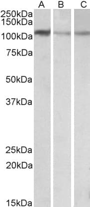 IHC-plus™ FTHFSDC1 / MTHFD1L Antibody (aa578-591)