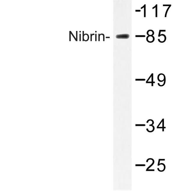 NBN / Nibrin Antibody (Pro461)