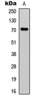 Polyclonal Rabbit anti-Human F11 / FXI / Factor XI Antibody (N-Terminus, WB)