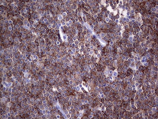 Monoclonal Mouse anti-Human TFPI2 Antibody (clone OTI1D4, aa23-235, IHC, WB)
