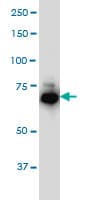 IHC-plus™ Monoclonal Mouse anti-Human IRAK1 / IRAK Antibody (clone 3A9, IHC, IF, WB)