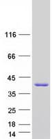 Human SULT1A4 / Sulfotransferase 1A4 Protein (Recombinant Myc-DDK (Flag))