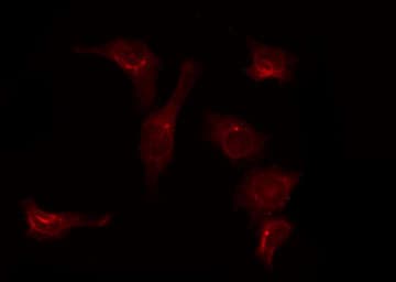 Polyclonal Rabbit anti-Human SLC39A7 / ZIP7 Antibody (IF, WB)