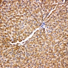 Polyclonal Rabbit anti-Human HSPA9 / Mortalin / GRP75 Antibody (aa591-609, IHC, WB)