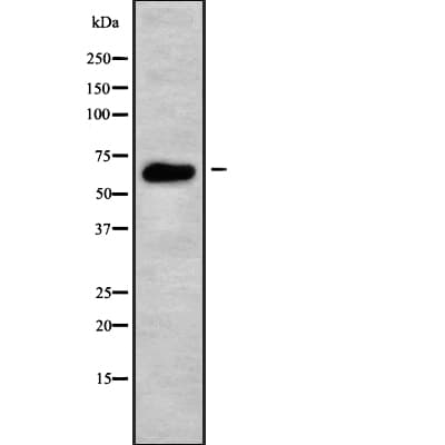 Polyclonal Rabbit anti-Human SF1 Antibody (IF, WB)